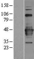 C22orf29 Protein (Over-Expression Lysate Myc-DDK (Flag))