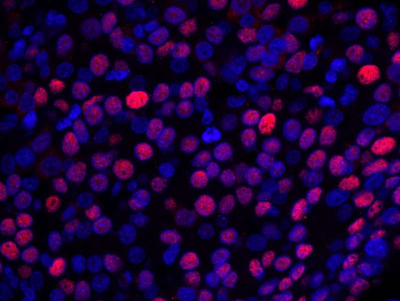 Polyclonal Rabbit anti-Human NUCKS1 Antibody (aa1-50, IHC, IF)