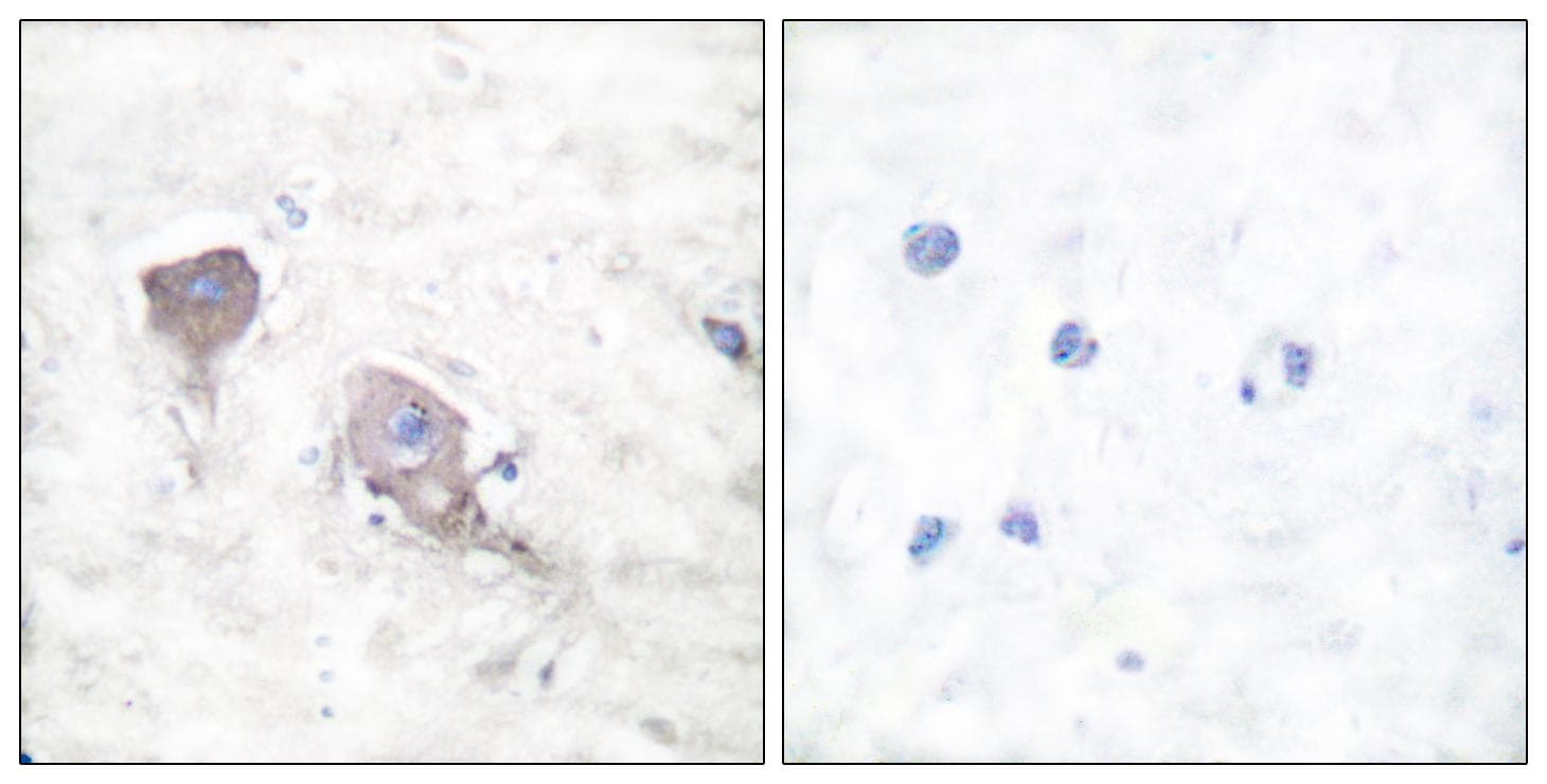 Polyclonal Rabbit anti-Human SNAP25 Antibody (IHC, WB)
