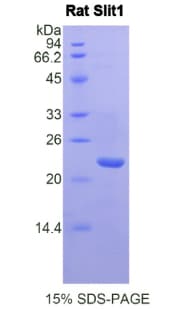 Rat SLIT1 Protein (Recombinant His)