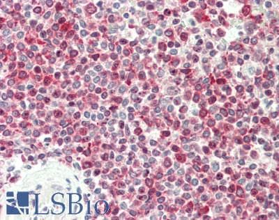 IHC-plus™ Polyclonal Rabbit anti-Human RPS6 / Ribosomal Protein S6 Antibody (aa200-C-term, IHC, WB)