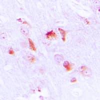 Polyclonal Rabbit anti-Human APOL2 / Apolipoprotein L 2 Antibody (Internal, IHC, IF, WB)
