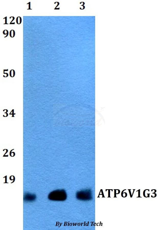 Polyclonal Rabbit anti-Human ATP6V1G3 Antibody (WB)