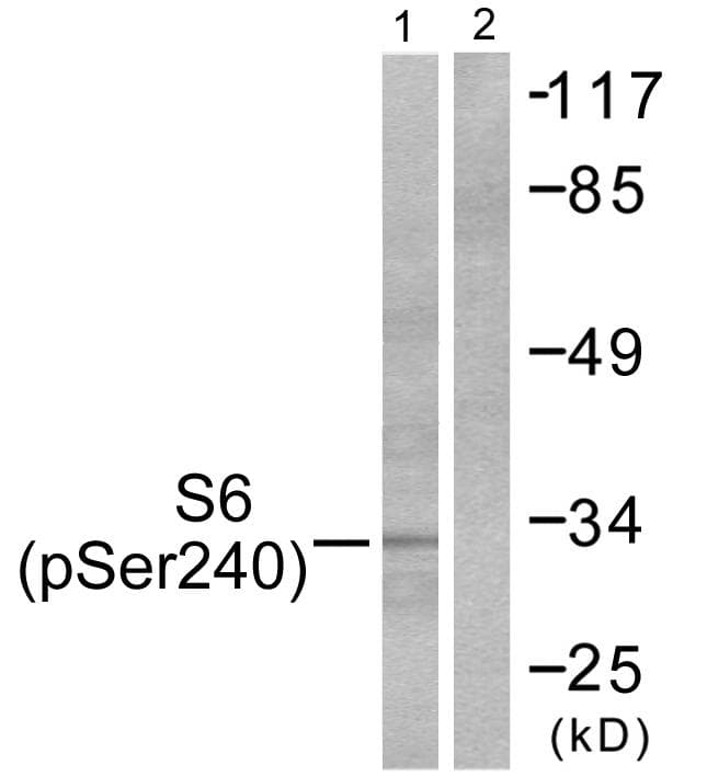 RPS6 / Ribosomal Protein S6 Antibody (phospho-Ser240)