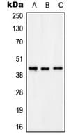 Polyclonal Rabbit anti-Human KCNAB3 Antibody (C-Terminus, IHC, WB)