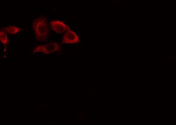 Polyclonal Rabbit anti-Human CYP39A1 Antibody (IF, WB)