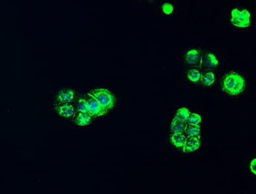 Alpha-Fetoprotein Antibody (aa19-397, clone OTI4G9)