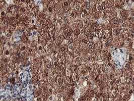 MEF2C Antibody (clone OTI2B12, Carrier-free)