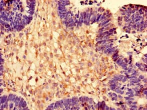 RPL28 / Ribosomal Protein L28 Antibody