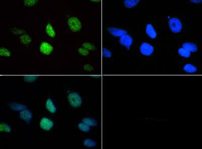 HIST3H3 Antibody (Me3-Lys18)