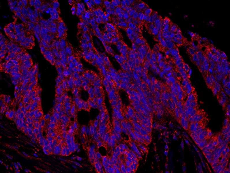 Polyclonal Rabbit anti-Human AKAP1 / AKAP Antibody (aa375-425, IHC, IF)
