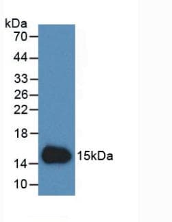 CST3 / Cystatin C Antibody (PE)