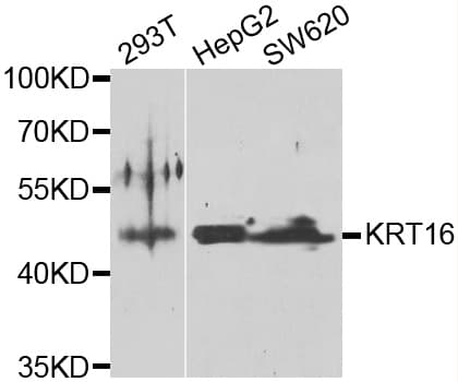 KRT16 / CK16 / Cytokeratin 16 Antibody