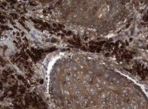 NME1 / NM23 Antibody (clone UMAB91)