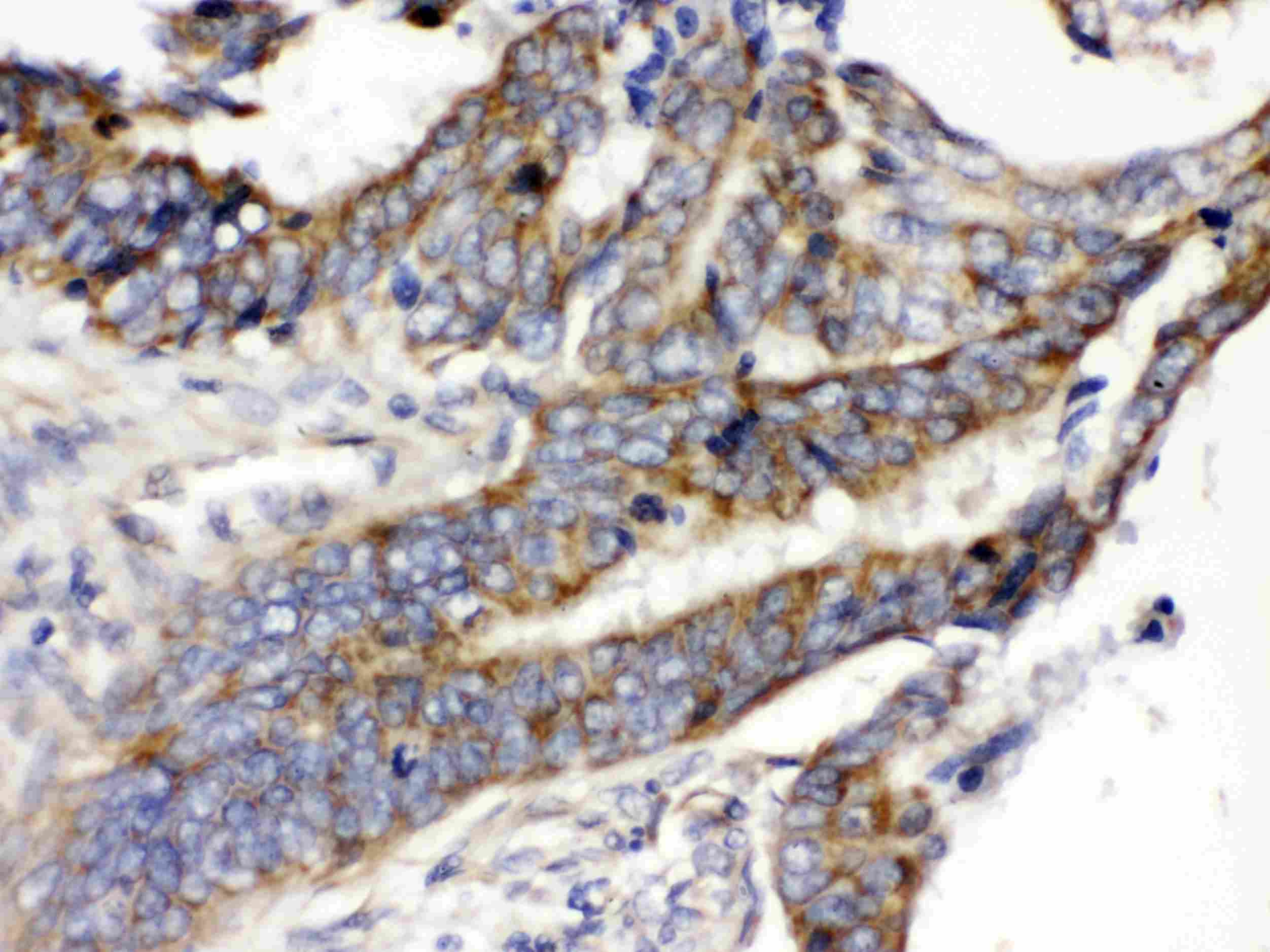 SLC2A5 / GLUT5 Antibody