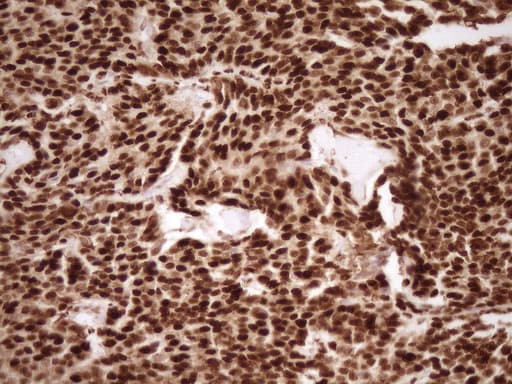 SAE1 Antibody (clone OTI6C7)