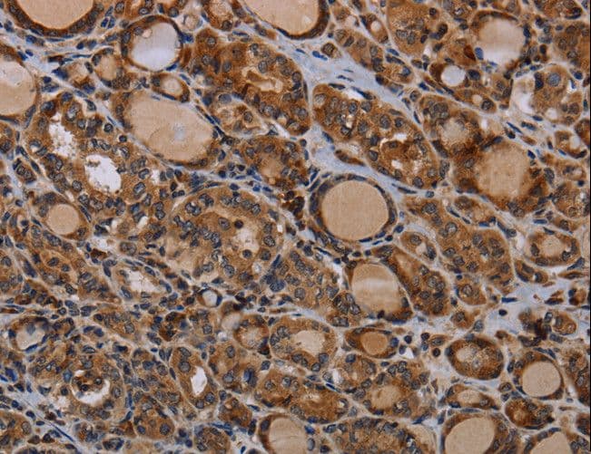 PAPPA / PAPP-A Antibody