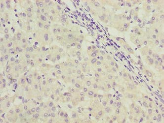 Polyclonal Rabbit anti-Human C9orf64 Antibody (IHC, WB)