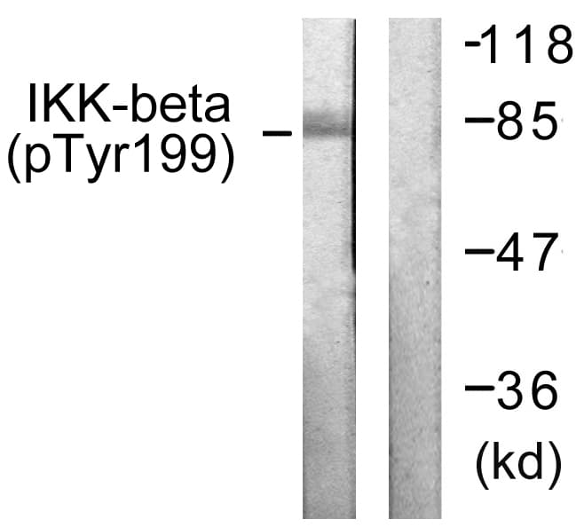 IKBKB / IKK2 / IKK Beta Antibody (phospho-Tyr199)