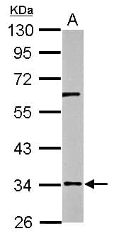 IHC-plus™ RPUSD3 Antibody