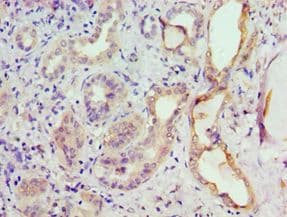 GRK6 Antibody (aa1-170)
