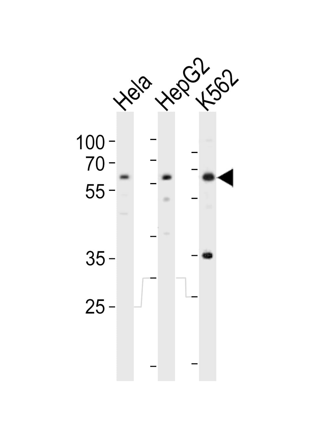RIOK3 Antibody (aa146-179)