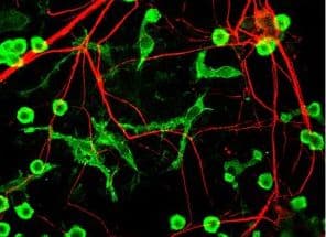 Polyclonal Chicken anti-Rat INA / Alpha Internexin Antibody (IF, WB)