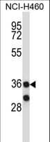 MARCH11 Antibody (aa308-337)