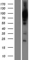 WDR48 Protein (Over-Expression Lysate Myc-DDK (Flag))