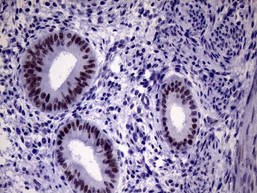 TSEN34 Antibody (clone OTI6B3, Carrier-free)