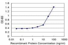 AMOG / ATP1B2 Antibody (clone 4E3)