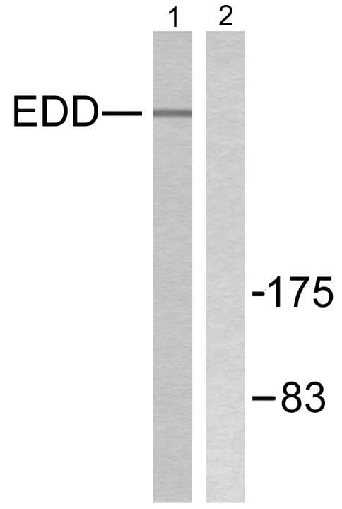 Polyclonal Rabbit anti-Human NEP / DDR1 Antibody (IHC, WB)