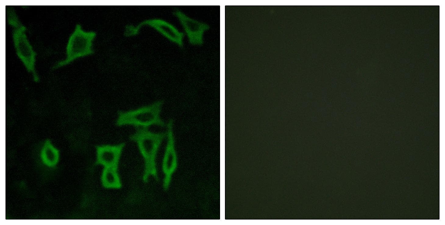 Polyclonal Rabbit anti-Human GRM5 / MGLUR5 Antibody (IF, WB)
