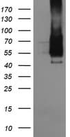 FCGR1A / CD64 Antibody (clone OTI3H9)