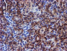 ERBB2 / HER2 Antibody (aa676-1255, clone OTI4G10, Carrier-free)