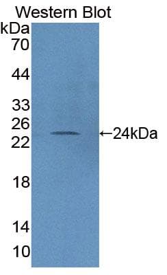 PTPRN2 / Phogrin Antibody