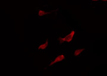 MAPK8 / JNK1 Antibody