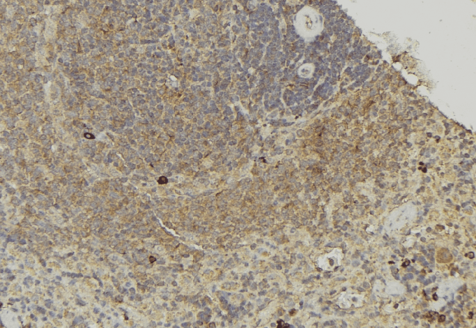 TCTN1 Antibody
