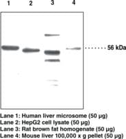 Polyclonal Rabbit anti-Human PNPLA2 / ATGL Antibody (IHC, WB)