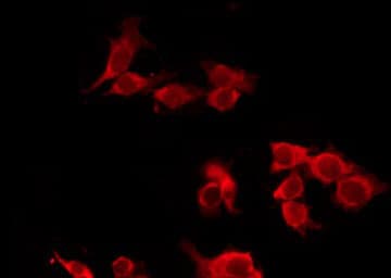 CHRM5 / M5 Antibody