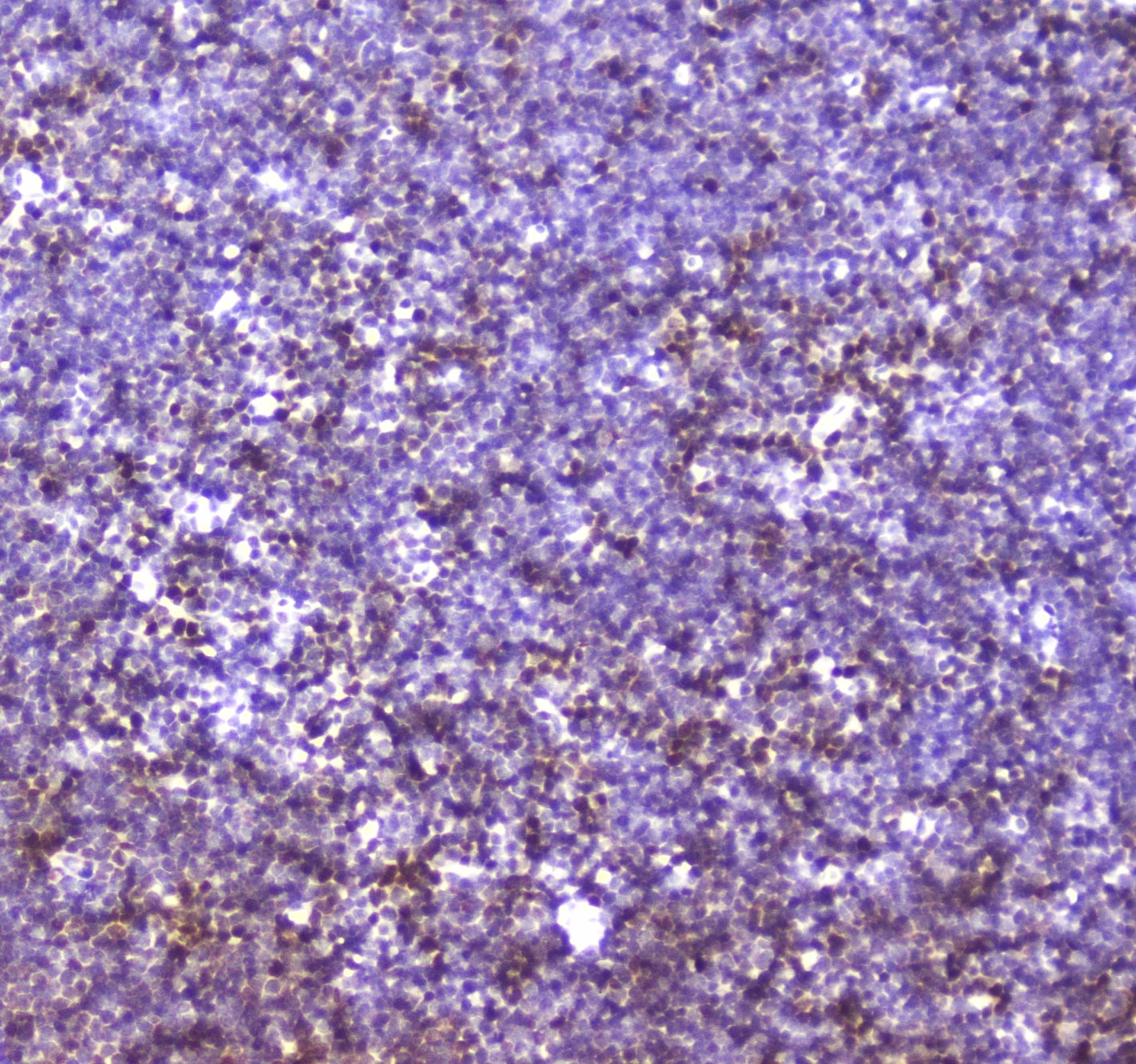 CBFB Antibody