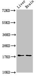 HSPB6 / HSP20 Antibody