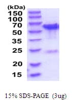 Human TBC1D22B Protein (Recombinant His)