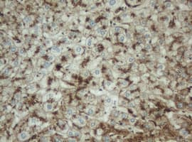 PPT1 / CLN1 Antibody (clone OTI1F10)
