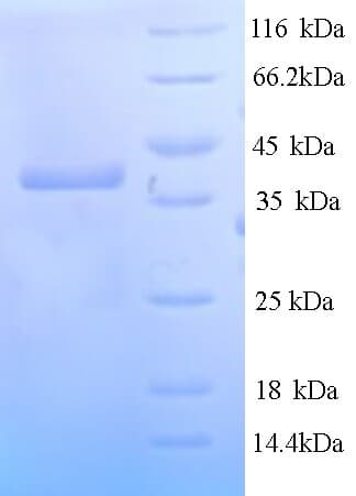 E. coli Hygromycin-B 4-O-kinase Protein (Recombinant His)