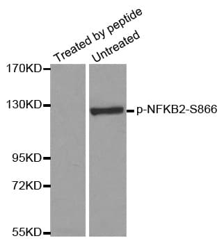 NFKB2 Antibody (phospho-Ser866)