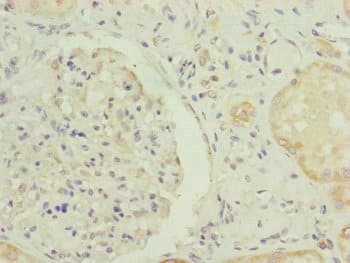 Polyclonal Rabbit anti-Human RNF139 / TRC8 Antibody (IHC)