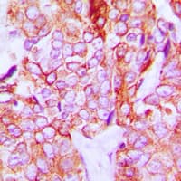 Polyclonal Rabbit anti-Human ERBB3 / HER3 Antibody (C-Terminus, IHC, IF, WB)