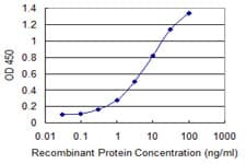Monoclonal Mouse anti-Human QPCT / QC Antibody (clone 3G2, IHC)
