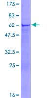 Human BPOZ / ABTB1 Protein (Recombinant GST)